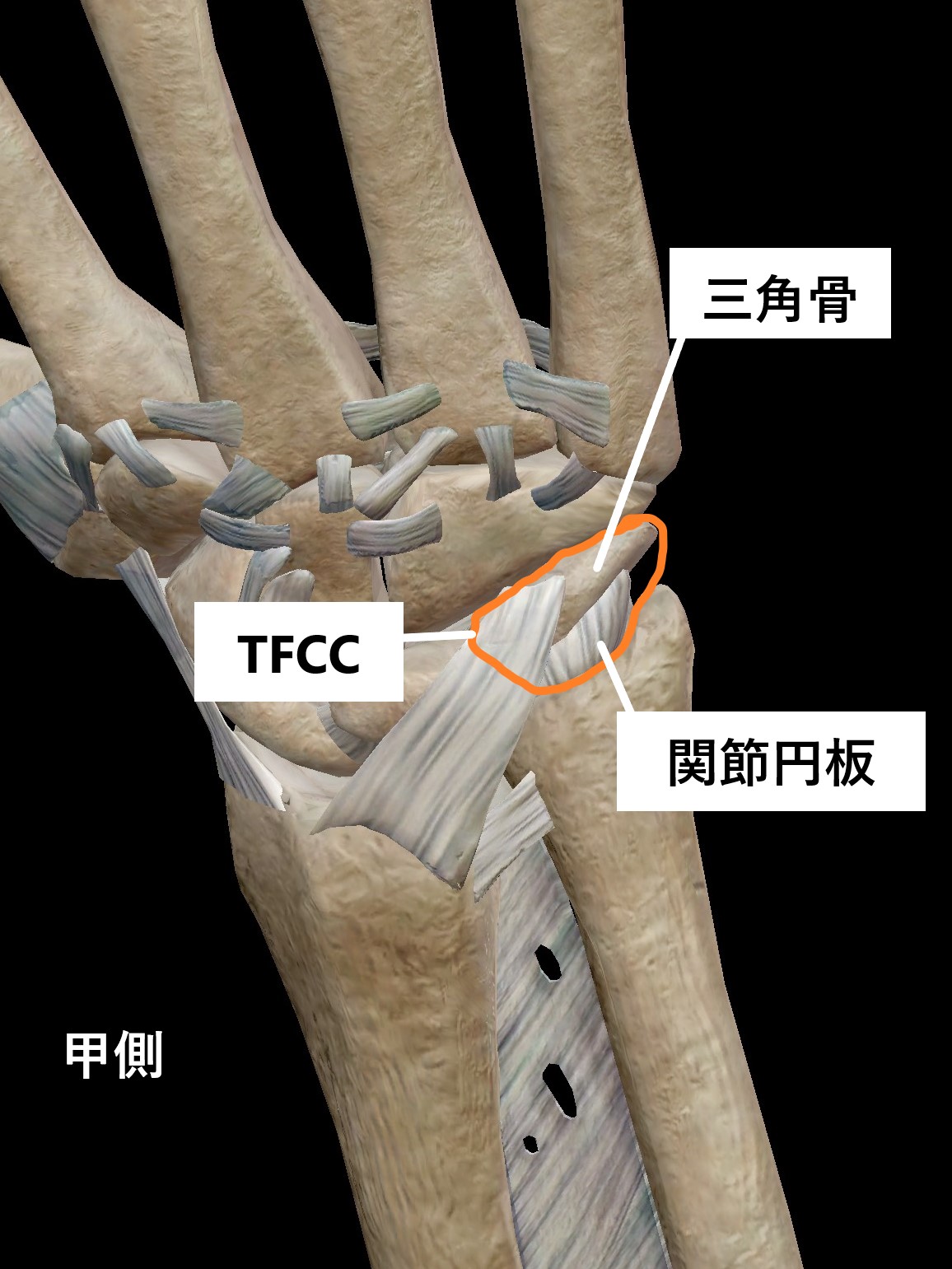 三角骨手首: 手の三角骨骨折 写真 – BDMC