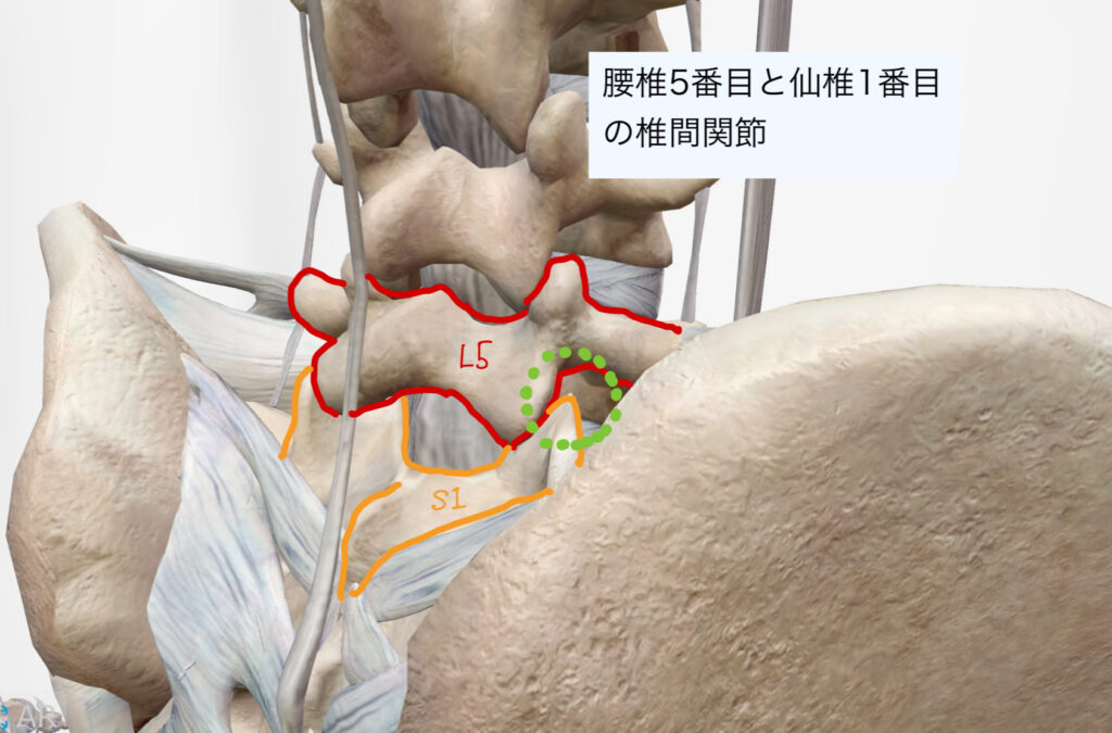 L5S1の椎間関節