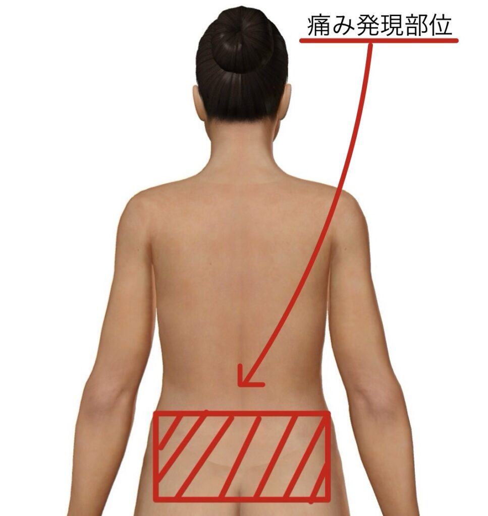 10代腰痛1