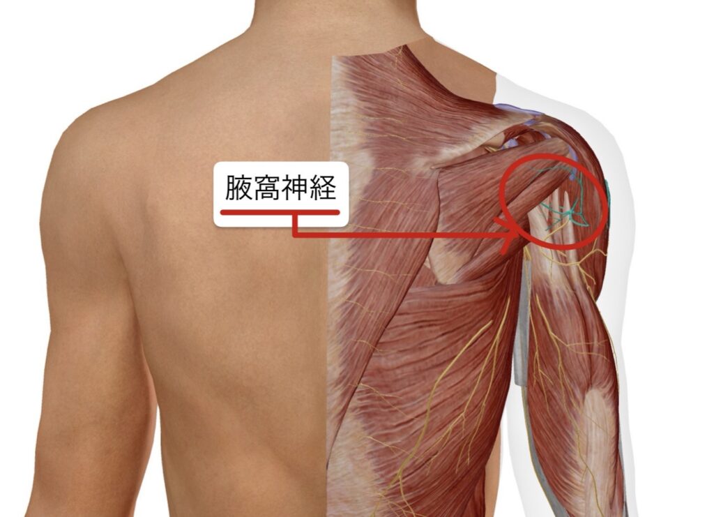 20代肩痛3