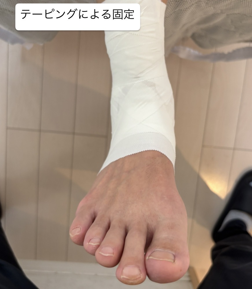 10代捻挫3